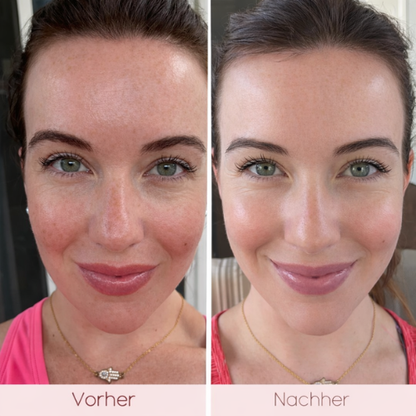 Illumis Rotlicht Therapie Maske